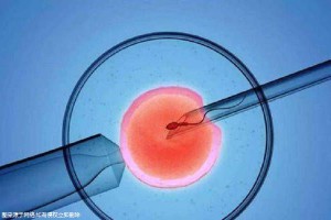 着床前診断 PGT